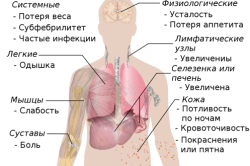 Признаки рака костного мозга
