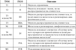 Классификация рака яичек