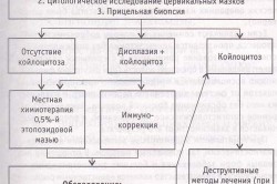 Алгоритм лечения  рака шейки матки
