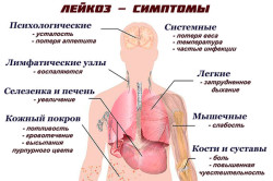 Основные симптомы лейкоза