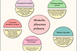 Методы удаления родинок