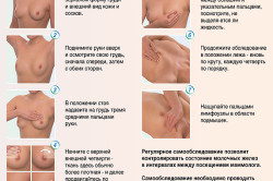 Самообследование молочной железы