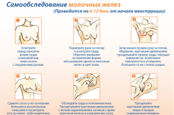 Самообследование молочных желез