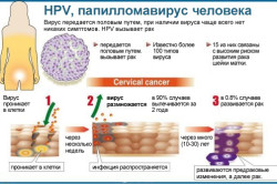 Папилломавирусная инфекциия - причина развития рака