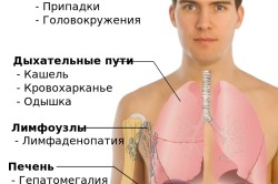 Основные места и симптомы метастазов рака