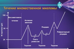 Течение множественной миеломы