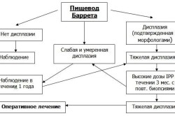 Тактика ведения больных с пищеводом Баррета