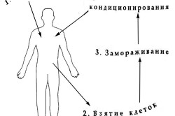 Алгоритм пересадки стволовых клеток
