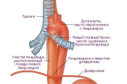 Устройство пищевода
